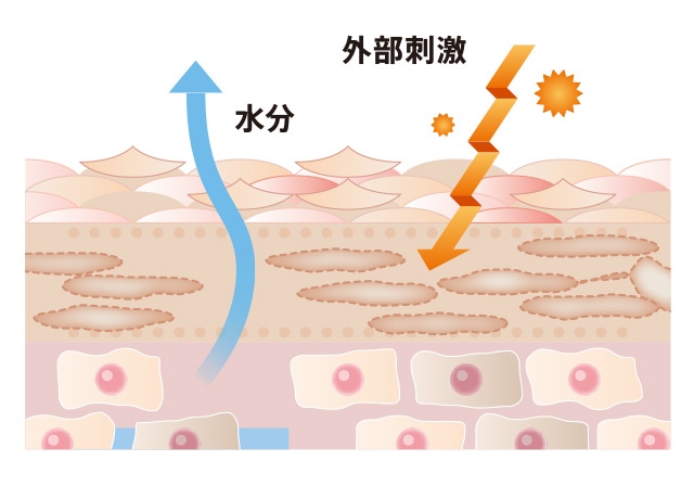 乾燥肌のイメージ